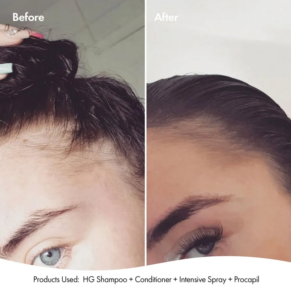 BondiBoost Procapil Scalp Tonic 125ml